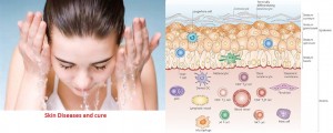 Skin Diseases and Cure