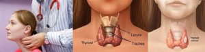 Thyroid Disease and Treatment