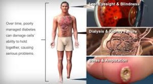 Diabetes-Heart disease-Stroke-Symptoms-Long Term Complications and their Natural Treatment
