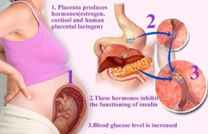 Gestational Signs of Diabetes Mellitus
