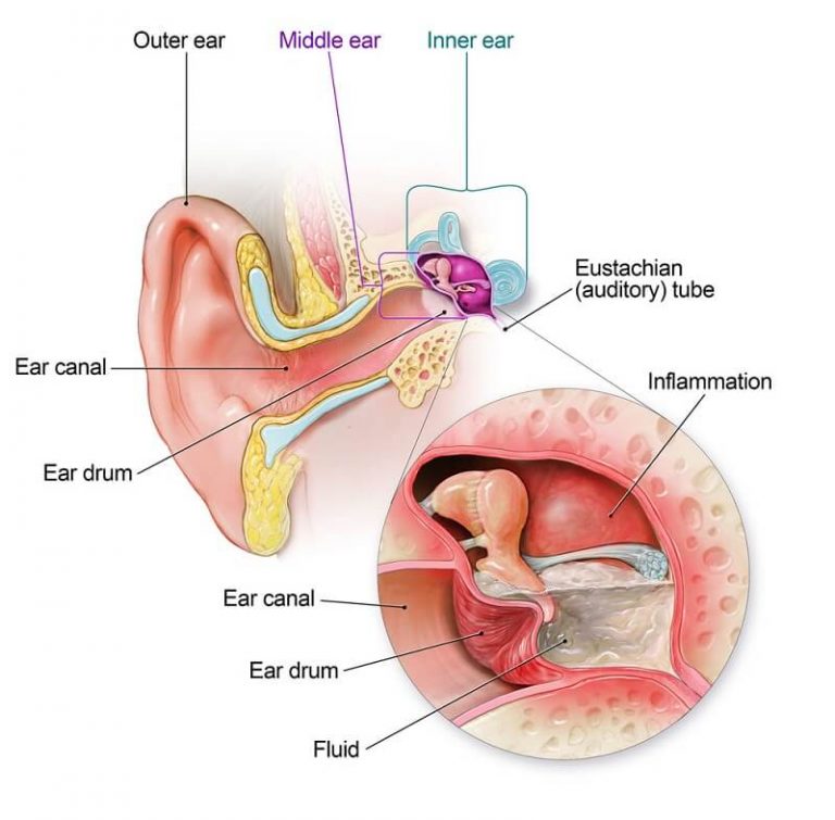 causes-of-ear-infection-apex-hospital-emergency-traumacare-ent